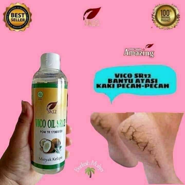 💧Pecah piring bisa di ganti 💧Pecah hati sulit terobati..💧kaki pecah-pecah ...? kasih VCO SR12 aja insyaAllah ampuh🤩🤩🤩Bisa di oles aja atau di minum aja,  bisa juga dua-duanya  lebih afdhol lebih Joss 💪💪💪Nggak perlu digerus, nggak perlu di amplas apalagi di silet2 🙈 no no no no 👎Sekarang Sudah ada VCO SR12 solusinya ya..🤩👍 okkkeyyyyOrder dan konsultasi (free) silahkan japri ya...Wa/telegram 👉0821-5799-8873Agen Resmi SR12 Herbal Skin care Balikpapan, KAL-TIM