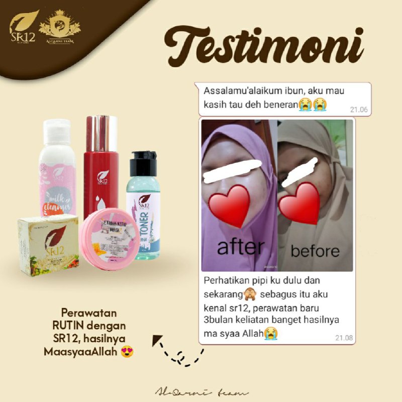 Toner BHA rekomended banget bagi kamu yang punya jerawat bruntus, Selain efektif menghempaskan jerawat  kulitmu juga  jadi cerah alami glowing semriwinggg bebas kusam 👍👍👍Ready stok ya.Buruan dipinang ...WA/telegram 👉 0821-5799-8873AGEN RESMI SR12 HERBAL SKINCARE BALIKPAPAN KAL-TIMMampir ke shopeeku yuks 👇shopee.co.id/agenresmisr12Atautokopedia.com/sr12balikpapanToner BHA rekomended banget bagi kamu yang punya jerawat bruntus, Selain efektif menghempaskan jerawat  kulitmu juga  jadi cerah alami glowing semriwinggg bebas kusam 👍👍👍Ready stok ya.Buruan dipinang ...WA/telegram 👉 0821-5799-8873AGEN RESMI SR12 HERBAL SKINCARE BALIKPAPAN KAL-TIMMampir ke shopeeku yuks 👇shopee.co.id/agenresmisr12Atautokopedia.com/sr12balikpapan