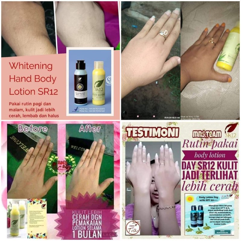 Jangan hanya wajah saja yang  dirawat ya,Kulit badan, tangan dan kaki juga penting loh untuk dirawat🤗 biar nggak belangDg HandBody SR12, Putihnya bersih cerah alami, bukan pucat, nggak memaksa yg asli hitam  menjadi berubah jadi putih.SR12 itu herbal sehat mnyehatkan, mncerahkan sampai batas maksimal warna asli kulit kita, kalau asli nya hitam ya tetap hitam tapi sehat bersih cerah alami,Jadi CINTAI KULIT MU ya dear💝Ready kemasan baru botol hijau💐Khasiat dan kualitas tetap sama, ampuh cerahkan kulitmu, bikin lembut, lembab, sehat, cerah alami bebas belang, bebas kusam bin kucel🤗Hanya ganti busana nya saja ya🌸🌿 Lightening Body Lotion (Siang)           With SPF 30, Olive oil🌸🌿 Whitening Body Lotion (Malam)           With Aloe VeraAromanya wangi nya khas, beda dari yg lain, tidak terasa lengket2, adem menenangkan tidak menyengat, langsung meresap ke kulit muWA/Telegram👉0821-5799-8873AGEN RESMI SR12 HERBAL SKINCARE BALIKPAPAN KAL-TIMshopee.co.id/agenresmisr12Atautokopedia.com/sr12balikpapan