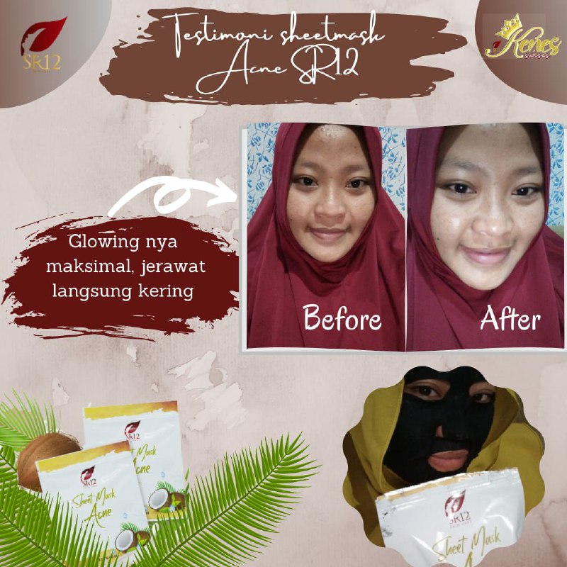 Sheet Mask Acne SR12 adalah  MASKER lembaran praktis dan kekinian yang ampuh hempaskan jerawat dan mengatasi minyak berlebih pada wajah namun tidak menyebabkan kulit kering.Wajah jadi cerah alami dan terjaga kelembabannya🥰 Wajah Glowing maksimal jerawat minggaat👍👍👍Ready Stock🤩🤩🤩🌿Sheet Mask Acne SR12WA/telegram 👉0821-5799-8873AGEN RESMI SR12 HERBAL SKINCARE BALIKPAPAN KAL-TIMMampir yuks ke shopeeku👇shopee.co.id/agenresmisr12Atau tokpedku👇tokopedia.com/sr12balikpapanSheet Mask Acne SR12 adalah  MASKER lembaran praktis dan kekinian yang ampuh hempaskan jerawat dan mengatasi minyak berlebih pada wajah namun tidak menyebabkan kulit kering.Wajah jadi cerah alami dan terjaga kelembabannya🥰 Wajah Glowing maksimal jerawat minggaat👍👍👍Ready Stock🤩🤩🤩🌿Sheet Mask Acne SR12WA/telegram 👉0821-5799-8873AGEN RESMI SR12 HERBAL SKINCARE BALIKPAPAN KAL-TIMMampir yuks ke shopeeku👇shopee.co.id/agenresmisr12Atau tokpedku👇tokopedia.com/sr12balikpapan