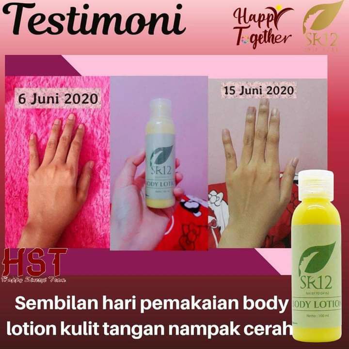 CERAH maksimal ya sesuai warna asli kulit kita, bukan mengelupas sampai lapisan epidermis sehat ya,  bukan  putih pucat bikin begidik😅 SR12 itu mengembalikan ke warna dasar kulit kita tapi tampak cerah Alami sehat terawat, no belang-belang,  no instan butuh kesabaran rutin dan telaten...insyaAllah berbuah maniezzz 🥰💐Aroma wangi nya khas, lembut, tidak menyengat, nggak ngebosenin, beda dari HandBody lain🤩Ready yang kemasan baru:🌸🌿Handbody/Lightening body lotion (Siang)🌸🌿 Handbody /Whitening body lotion (malam)Wa/telegram 👉0821-5799-8873AGEN RESMI SR12 HERBAL SKINCARE BALIKPAPAN,  KAL-TIMAtau silahkan kunjungi toko online kami di 👇🌿 