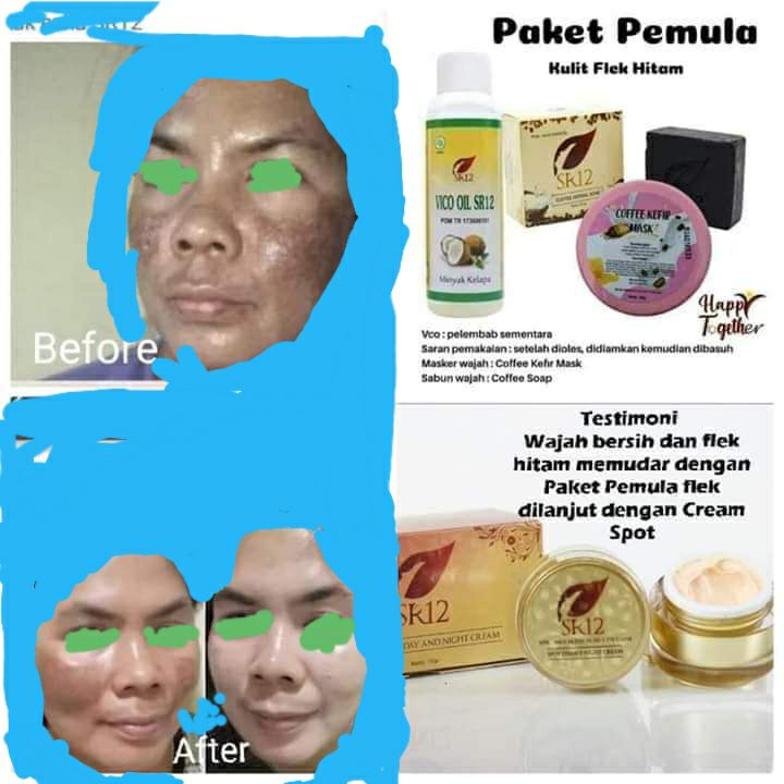 Kalopun kamu bisa putih dg SR12 itu karena warna asli kulitmu emang putih, jadi kalau pada dasarnya emang hitam tetap aja hitam, tapi di bikin cerah Alami oleh SR12SR12 tidak mengganti warna asli kulit mu , melainkan mengembalikan kecantikan alami kulit.Karena CANTIK itu tidak harus PUTIH. yang penting kulit cerah sehat terawatYuk beralih ke herbal alami aja, yaitu SR12 HERBAL SKINCARE.👉Jelas Ownernya👉Jelas merk/Brandnya, bukan tempel-tempelan.👉Jelas komposisinya 👉sudah BPOM👉Bonafit perusahaannya.Wajah SR12 itu cerah alami ya, putih nya bukan putih pucat, bukan licin, nggak ngelupas merah2🤭, wajah SR12 itu wajah Herbal alami, perawatan SR12 itu mengembalikan kecantikan alami kulitmu, mengeluarkan racun2/zat2 kimia berbahaya lainnya yg menumpuk di wajahmu, memutus siklus ketergantungan terhadap kosmetik sebelumnya, mencerahkan secara maksimal sesuai warna asli kulit kita.Order/Konsultasi (Free)Silahkan Hubungi:Wa/telegram 👉0821-5799-8873AGEN RESMI SR12 HERBAL SKINCARE BALIKPAPAN, KAL-TIM