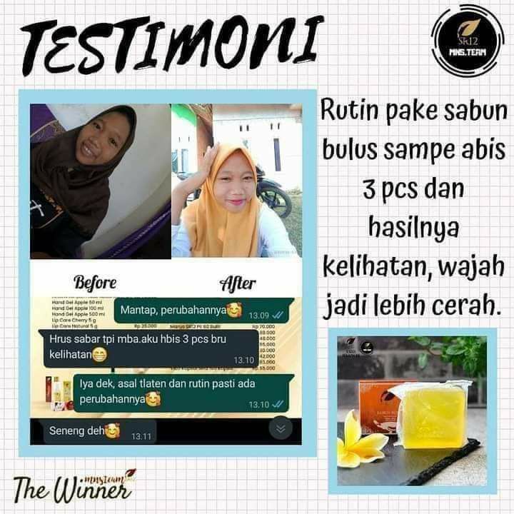 Kalau wajah belum pernah tercemar dengan yg nama nya mercury & hidroquinon and teman2 sepersaudaraan itu ya😬🤗Maka perawatan dengan menggunakan sabun aja akan kelihatan memuaskan hasil nya...Apalagi buat kamu para remaja, yg kulit nya masih alami, nggak usah neko-neko, nggak usah dimacem-macemin, nggak usah dirubah2 warna nya sampai tekupas2 merah licin melene gitu yah , cukup pakai perawatan alami aja, pakai sabun herbal dari SR12 dan pakai suncare SR12, utk perlindungan dari sinar matahari saja udah membuat wajahmu cerah sehat Alami.okkey.InsyaaAllah, ready stock  paket perawatan Daily Remaja (perawatan  Harian Remaja).Order/konsultasi(free)Wa/telegram👉0821-5799-8873AGEN RESMI SR12 HERBAL SKINCARE BALIKPAPAN