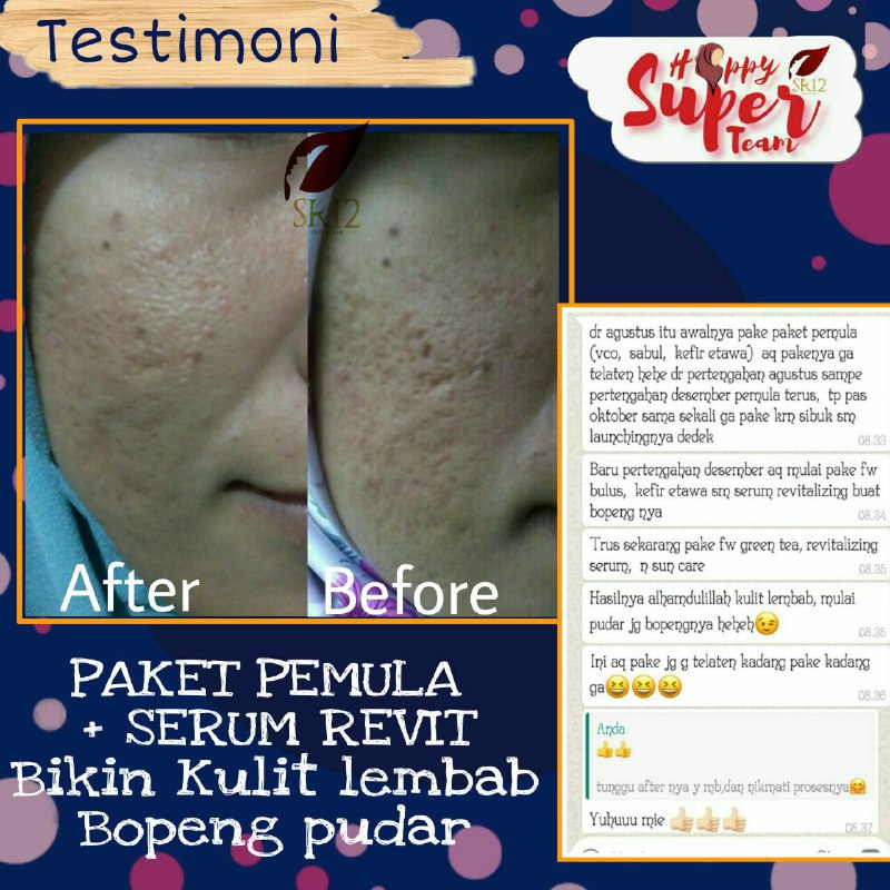 🌴Revitalizing Serum🌴Revitalizing Serum membantu mulusin wajah yg berlubang2 alias bopeng/scarSerum ini asli herbal alami ya, terbuat dari VCO, teripang Laut dan lain-lain, serum ini juga membuat kulit mu cerah, kenyal, lembab dan menyamarkan kerutan2 sehingga tampak muda  kembali😉🤩Yok dipinang yokReady ya 🤩Wa/telegram 👉0821-5799-8873AGEN RESMI SR12 HERBAL SKINCARE BALIKPAPAN, KAL-TIMIntips shopeeku yuks👇shopee.co.id/agenresmisr12Atau tokpedku 👇tokopedia.com/sr12balikpapan🌴Revitalizing Serum🌴Revitalizing Serum membantu mulusin wajah yg berlubang2 alias bopeng/scarSerum ini asli herbal alami ya, terbuat dari VCO, teripang Laut dan lain-lain, serum ini juga membuat kulit mu cerah, kenyal, lembab dan menyamarkan kerutan2 sehingga tampak muda  kembali😉🤩Yok dipinang yokReady ya 🤩Wa/telegram 👉0821-5799-8873AGEN RESMI SR12 HERBAL SKINCARE BALIKPAPAN, KAL-TIMIntips shopeeku yuks👇shopee.co.id/agenresmisr12Atau tokpedku 👇tokopedia.com/sr12balikpapan