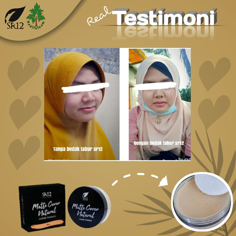 Jika dirimu nggak suka bedak padat, di SR12 ada kok yg taburTinggal pilih yg mana yg disuka.SR12 selalu ada untukmu, untukmu dan untukmu 🤗🥰😁Bedak Tabur SR12 cocok banget buat kulit berminyak...malah tahan banget sampe sore lo...nggak gampang luntur👍Bedak SR12 cocok kok untuk semua jenis kulit...🤩👍Ready stock🤩🤩🤩Harga : 85 ribuWA/Telegram👉0821-5799-8873AGEN RESMI SR12 HERBAL SKINCARE BALIKPAPAN, KAL-TIMMampir ke shopeeku yuk👇shopee.co.id/agenresmisr12Atau tokpedku👇tokopedia.com/sr12balikpapanBisa pakai voucher free ongkir dan bisa COD juga lo... dapatkan harga terbaik sesuai katalog dan promo menarik lainnya. GERCEEP🎉