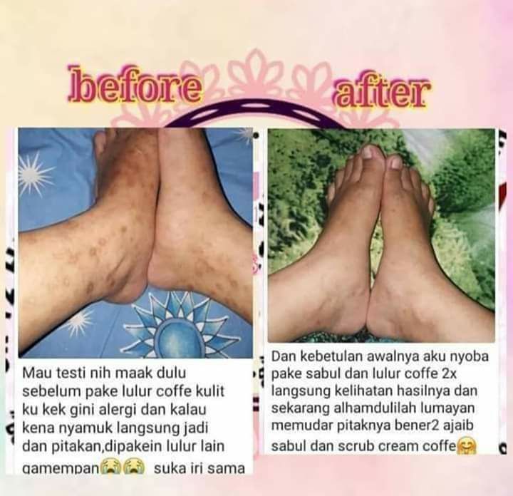 Rutin Pakai Lulur Scrub Coffee SR12 dan sabun bulus SR12 👍👍👍