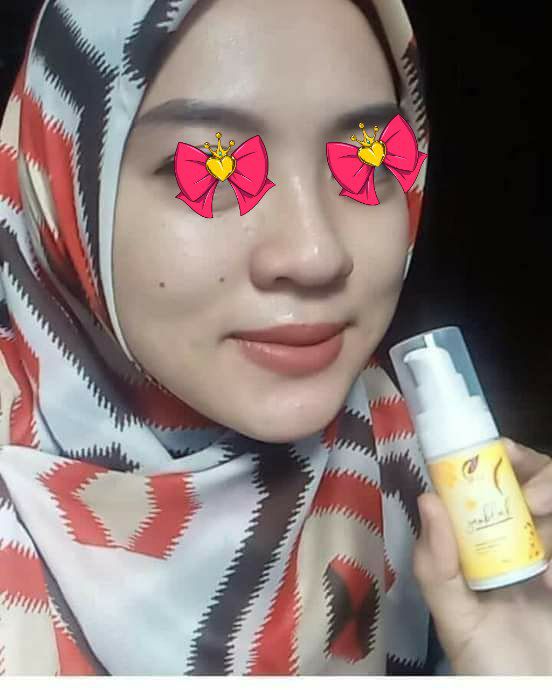 💥🌿SUNBLOCK SR12🌿💥Sudah saatnya kita lebih care terhadap kebutuhan kulit kita. Sunblock SR12 ini selain untuk perlindungan dari paparan sinar UV juga masih ada lagi manfaat lainnya, seperti :1. Membantu mencegah penuaan dini2. Membantu menurunkan resiko kanker3. Membantu mencegah penggelapan kulit4. Membantu meningkatkan kesehatan kulitYuk segera di miliki, buktikan khasiat dan keampuhan nya, wajah jadi terlindungi serta bersih cerah alami Wa/telegram 👉0821-5799-8873AGEN RESMI SR12 HERBAL SKINCARE BALIKPAPAN, KAL-TIM💥🌿SUNBLOCK SR12🌿💥Sudah saatnya kita lebih care terhadap kebutuhan kulit kita. Sunblock SR12 ini selain untuk perlindungan dari paparan sinar UV juga masih ada lagi manfaat lainnya, seperti :1. Membantu mencegah penuaan dini2. Membantu menurunkan resiko kanker3. Membantu mencegah penggelapan kulit4. Membantu meningkatkan kesehatan kulitYuk segera di miliki, buktikan khasiat dan keampuhan nya, wajah jadi terlindungi serta bersih cerah alami Wa/telegram 👉0821-5799-8873AGEN RESMI SR12 HERBAL SKINCARE BALIKPAPAN, KAL-TIM