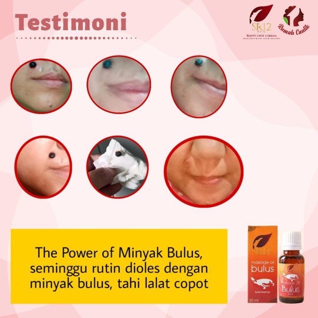 Mau rontokin kutil dan tahi lalat ???Bulusin aja pakai minyak Bulus SR12Solusi jitu yg mau kulit mulus dan sehat tapi nggak suka pakai CreamWA/Telegram👉0821-5799-8873AGEN RESMI SR12 HERBAL SKINCARE BALIKPAPAN KAL-TIM
