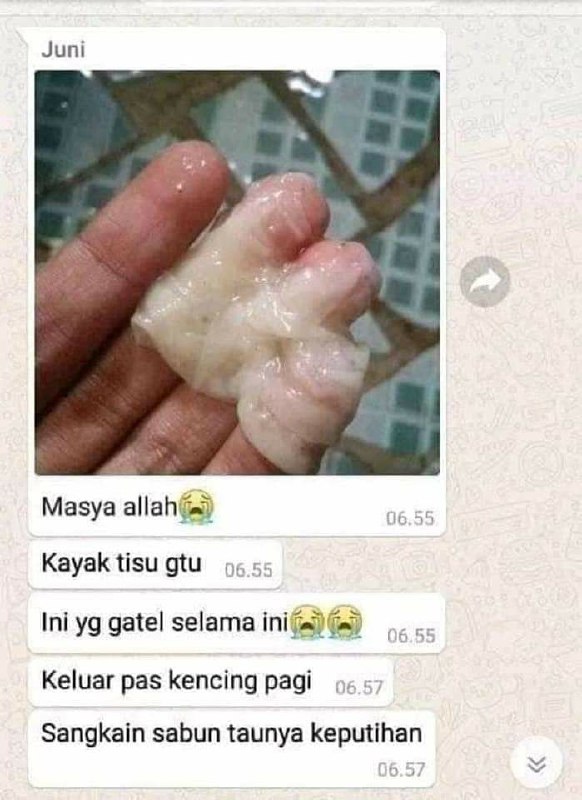 Maaf bukannya jorok ya, tapi kalau yg begini masih bersarang di organ kewanitaan dan nggak segera dikeluarkan dan di atasi, bisa bahaya, karena ini adalah KEPUTIHAN  yng tidak normal.  Jika ini terjadi pada anda, jangan di biarkan dan dianggap remeh, Sebelum merambat kebagian lain dari organ kewanitaan anda, bisa berakibat fatal, bahkan ada yg sampai menganggu sistem reproduksi anda. Juga mengganggu keharmonisan hubungan suami istri🥀segera atasi dengan MANJAKANI SR12. Manjakani SR12 ini 100% HERBAL alami yang diambil dari manjakani asli ACEH dan VCO SR12, sudah banyak yg buktikan khasiat dan keampuhan dari si manja ini. MaasyaAllah🌿Yuk  kepoin dan segera di order dan konsumsi rutin ya sesuai aturan pakainya Konsultasi (free)Ready stock: 🌷Manja butir 🌷Manja Kapsul❤️Wa/telegram 👉0821-5799-8873AGEN RESMI SR12 HERBAL SKINCARE BALIKPAPAN, KAL-TIMshopee.co.id/agenresmisr12Atautokopedia.com/sr12balikpapanBisa pakai voucher free ongkir dan bisa COD juga lo..🎉Maaf bukannya jorok ya, tapi kalau yg begini masih bersarang di organ kewanitaan dan nggak segera dikeluarkan dan di atasi, bisa bahaya, karena ini adalah KEPUTIHAN  yng tidak normal.  Jika ini terjadi pada anda, jangan di biarkan dan dianggap remeh, Sebelum merambat kebagian lain dari organ kewanitaan anda, bisa berakibat fatal, bahkan ada yg sampai menganggu sistem reproduksi anda. Juga mengganggu keharmonisan hubungan suami istri🥀segera atasi dengan MANJAKANI SR12. Manjakani SR12 ini 100% HERBAL alami yang diambil dari manjakani asli ACEH dan VCO SR12, sudah banyak yg buktikan khasiat dan keampuhan dari si manja ini. MaasyaAllah🌿Yuk  kepoin dan segera di order dan konsumsi rutin ya sesuai aturan pakainya Konsultasi (free)Ready stock: 🌷Manja butir 🌷Manja Kapsul❤️Wa/telegram 👉0821-5799-8873AGEN RESMI SR12 HERBAL SKINCARE BALIKPAPAN, KAL-TIMshopee.co.id/agenresmisr12Atautokopedia.com/sr12balikpapanBisa pakai voucher free ongkir dan bisa COD juga lo..🎉