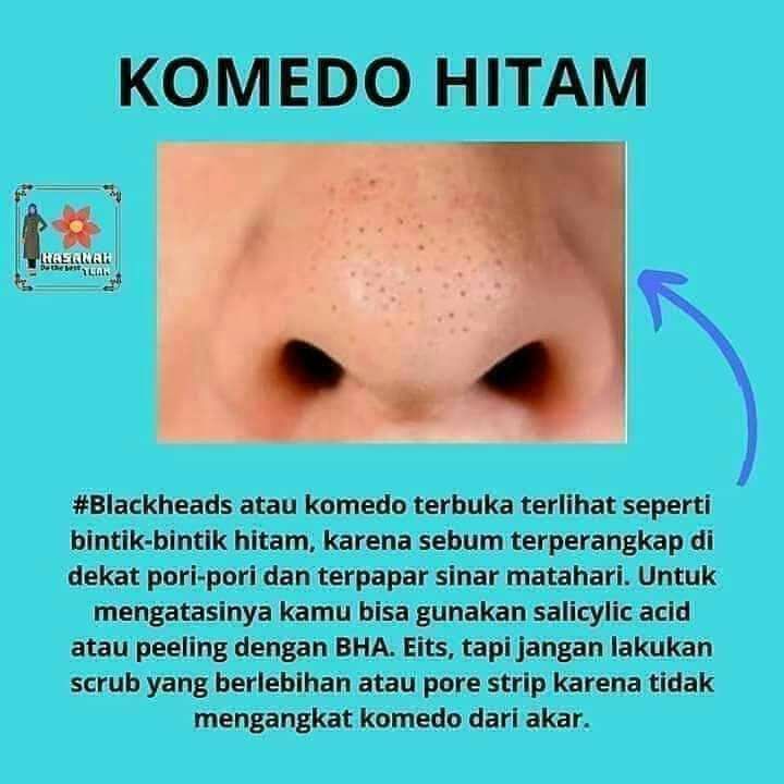 Anda komedoan? Komedo putih ataupun komedo hitam ..rontokin aja pakai Coffee Mask peeling SR12....Semua jenis komedo...mingggaaat...wajah cerah sehat berseri alami..produk SR12 ini aman dan sudah BPOMWa/telegram 👉0821-5799-8873AGEN RESMI SR12 HERBAL SKINCARE BALIKPAPANAnda komedoan? Komedo putih ataupun komedo hitam ..rontokin aja pakai Coffee Mask peeling SR12....Semua jenis komedo...mingggaaat...wajah cerah sehat berseri alami..produk SR12 ini aman dan sudah BPOMWa/telegram 👉0821-5799-8873AGEN RESMI SR12 HERBAL SKINCARE BALIKPAPAN