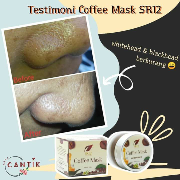 Hempaskan komedo tanpa rasa sakit hanya dengan 