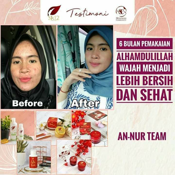 Wajah SR12 itu cerah Alami guysss..., putih nya bukan putih pucat, bukan licin meloneng 🤗 nggak ngelupas merah2🤭, wajah SR12 itu wajah Herbal alami, perawatan SR12 HERBAL SKINCARE itu mengembalikan kecantikan alami kulitmu, mengeluarkan racun-racun atau zat2 kimia berbahaya lainnya yg menumpuk di wajahmu, memutus siklus ketergantungan terhadap kosmetik sebelumnya, mencerahkan secara maksimal sesuai warna asli kulit kita.Beauty is not a dream,  Bringing back your beauty 🥰Order atau konsultasi(free):Wa/telegram 👉0821-5799-8873AGEN RESMI SR12 HERBAL SKINCARE BALIKPAPAN, KAL-TIM Insyaallah FAST RESPON 🤩🤩🤩shopee.co.id/agenresmisr12Atautokopedia.com/sr12balikpapanBisa pakai voucher free ongkir dan bisa COD juga lo GERCEEP🎉Wajah SR12 itu cerah Alami guysss..., putih nya bukan putih pucat, bukan licin meloneng 🤗 nggak ngelupas merah2🤭, wajah SR12 itu wajah Herbal alami, perawatan SR12 HERBAL SKINCARE itu mengembalikan kecantikan alami kulitmu, mengeluarkan racun-racun atau zat2 kimia berbahaya lainnya yg menumpuk di wajahmu, memutus siklus ketergantungan terhadap kosmetik sebelumnya, mencerahkan secara maksimal sesuai warna asli kulit kita.Beauty is not a dream,  Bringing back your beauty 🥰Order atau konsultasi(free):Wa/telegram 👉0821-5799-8873AGEN RESMI SR12 HERBAL SKINCARE BALIKPAPAN, KAL-TIM Insyaallah FAST RESPON 🤩🤩🤩shopee.co.id/agenresmisr12Atautokopedia.com/sr12balikpapanBisa pakai voucher free ongkir dan bisa COD juga lo GERCEEP🎉
