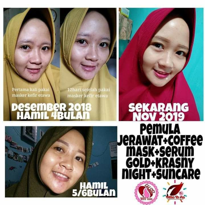 Siapa bilang kalo Bumil nggak bisa cantik dan perawatan ?🤔🤗Justru Kalau lagi hamil itu perlu perawatan ekstra, karena kulitnya bumil itu sensitif buanget, apalagi perasaan nya 🥰Jadi mesti di jaga ya kan?🤗Kudu di senangi, dibahagiakan dan di manjain.Na skincare-an dg produk SR12 InsyaAllah aman bagi bumil dan busui,  bisa merawat bumil tampil cantik, rilex dan bahagia🥰💐Yuk jaga Istrimu dan Calon ibu dari anak2 mu biar bahagia, karena kalau dia bahagia, anak2 mu tumbuh jd pribadi yg ceria, hidupmu pun akan terasa sempurna 💝MasyaAllahReady :🌸 Paket Pemula Hemat untuk Jenis kulit kering:       💓 Masker Milk KEFIR       💓 VCO SR12        💓 Sabun Madu/FW.Honey       💓 Sunblock 🌸 Paket Lanjutan Untuk Jenis kulit kering:        💓 Cream Krasny Day& Night        💓 Serum Krasny SR12Ready juga ya:🌿Paket pemula & lanjutan utk kulit berminyak dan sensitif 🌿Paket pemula & lanjutan utk  masalah kulit flek hitam parah & dalamWA/Telegram 👉0821-5799-8873AGEN RESMI SR12 HERBAL SKINCARE BALIKPAPAN KAL-TIM