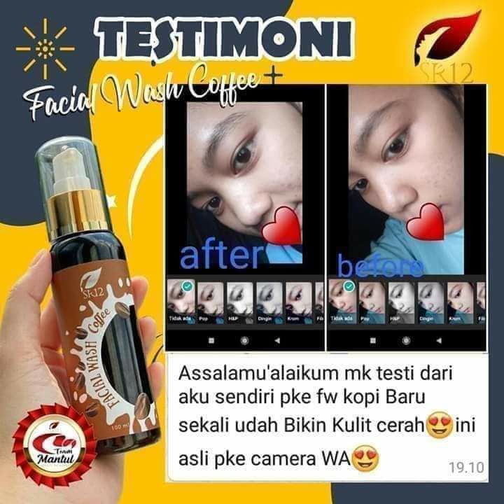 Ngopi yuuk...☕☕☕ Pecinta kopi mana suara nya??? Kalau wajah belum pernah tercemar produk yg aneh2, awal pemakaian pun berasa banget perubahan nyaBeda cerita kalau wajah udah banyak di teplokin produk abal-abal itu & ini, pemutih instan, mercury dkk, musti siap2 detoks dulu ya...🤗🙃🤩Facial Wash Coffee SR12 membantu mencerahkan kulit wajah mu, dengan kandungan VCO dan biji Jarak  sebagai pembusa alami sehingga tidak membuat kulit mu terasa kering atau rasa panas ketarik gitu ya.Aroma khas kopi nya mantuuul  serasa mau di seruput aja😬ada kayak aroma Es Cream kopi gitu yah🤭😁. Bener-bener herbal alami.Kulit jadi sehat cerah alami tanpa rasa khawatirReady 🤩🌴Facial Wash Coffee 🌴Coffee Soap  WA/Telegram👉0821-5799-8873AGEN RESMI SR12 HERBAL SKINCARE BALIKPAPAN KAL-TIMIntip-intip toko shopeeku yuk👇shopee*co*id/agenresmisr12Atau tokpedku 👇tokopedia*com/sr12balikpapan______untuk masuk link toko ⤴️  ( * ) ganti ( . )Bisa pakai voucher free ongkir dan bisa COD juga lo..(Shopee)