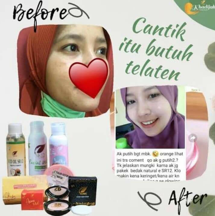 Assalamu'alaykum temans group...🥰🤩Sudah banyak yang membuktikan pembersih wajah milk cleanser SR12 ini lo😍Karena tidak bisa hanya dengan menggunakan facial wash/sabun saja kotoran terangkat dengan sempurna. Cara ampuh untuk mengangkat kotoran dan sisa make up sampai pori2 ...ya harus dengan double cleansing dengan milk cleanser SR12Setelah itu lanjut cuci muka nya pakai sabun /Facial wash SR12 sesuai jenis kulitmu ya dear..KARENA CANTIK itu BUTUH TELATEN🥰Yuk kepoin dan belanja segera...Ready stock ya...terbatasWA/telegram 👉 0821-5799-8873 AGEN RESMI SR12 HERBAL SKINCARE BALIKPAPAN, KAL-TIMAssalamu'alaykum temans group...🥰🤩Sudah banyak yang membuktikan pembersih wajah milk cleanser SR12 ini lo😍Karena tidak bisa hanya dengan menggunakan facial wash/sabun saja kotoran terangkat dengan sempurna. Cara ampuh untuk mengangkat kotoran dan sisa make up sampai pori2 ...ya harus dengan double cleansing dengan milk cleanser SR12Setelah itu lanjut cuci muka nya pakai sabun /Facial wash SR12 sesuai jenis kulitmu ya dear..KARENA CANTIK itu BUTUH TELATEN🥰Yuk kepoin dan belanja segera...Ready stock ya...terbatasWA/telegram 👉 0821-5799-8873 AGEN RESMI SR12 HERBAL SKINCARE BALIKPAPAN, KAL-TIM