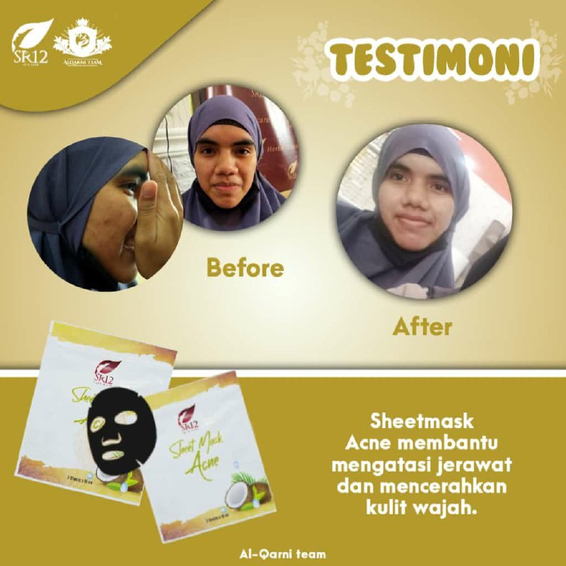 Sheet Mask Acne SR12 adalah  MASKER lembaran praktis dan kekinian yang ampuh hempaskan jerawat dan mengatasi minyak berlebih pada wajah namun tidak menyebabkan kulit kering.Wajah jadi cerah alami dan terjaga kelembabannya🥰 Wajah Glowing maksimal jerawat minggaat👍👍👍Ready Stock🤩🤩🤩🌿Sheet Mask Acne SR12WA/telegram 👉0821-5799-8873AGEN RESMI SR12 HERBAL SKINCARE BALIKPAPAN KAL-TIMMampir yuks ke shopeeku👇shopee.co.id/agenresmisr12Atau tokpedku👇tokopedia.com/sr12balikpapanSheet Mask Acne SR12 adalah  MASKER lembaran praktis dan kekinian yang ampuh hempaskan jerawat dan mengatasi minyak berlebih pada wajah namun tidak menyebabkan kulit kering.Wajah jadi cerah alami dan terjaga kelembabannya🥰 Wajah Glowing maksimal jerawat minggaat👍👍👍Ready Stock🤩🤩🤩🌿Sheet Mask Acne SR12WA/telegram 👉0821-5799-8873AGEN RESMI SR12 HERBAL SKINCARE BALIKPAPAN KAL-TIMMampir yuks ke shopeeku👇shopee.co.id/agenresmisr12Atau tokpedku👇tokopedia.com/sr12balikpapan