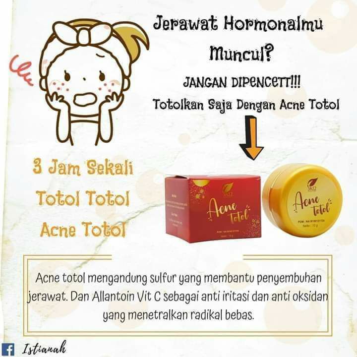 Jika jerawat Hormon mu muncul ketika menjelang haid, stress, ataupun wajah kotor, jangan galau ya guyyysss,itu NORMAL,  jangan dipencet2, jangan dipocel2, jangan ditusuk2 pake jarum,  jangan di kasih lipstik atau pun odol🤭 tapi segera totolin aja dengan ACNE TOTOL SR12 tiap 3  jam sekali, jerawat akan kempes, kering, serta ngelupas sendiri tanpa meninggalkan bekas hitam🤩😎👍👍 oiya totolinnya tepat di jerawatnya saja ya...Order/konsultasi (free)Wa/telegram:0821 5799 8873AGEN RESMI SR12 HERBAL SKINCARE BALIKPAPAN, KAL-TIM