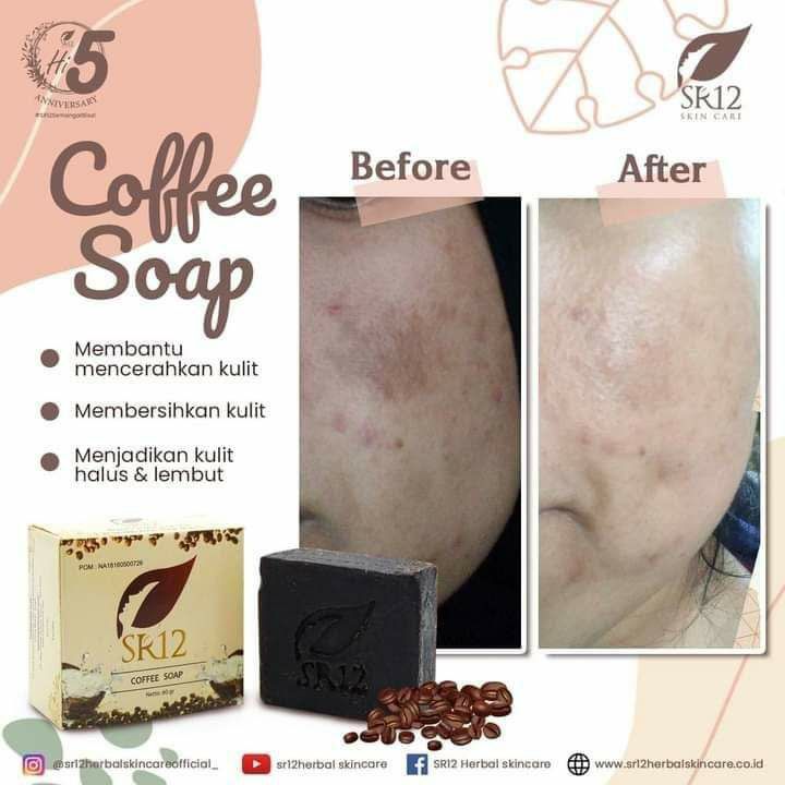 Ketika hasil sudah terlihat lebih baik dari sebelum nyaDalam hati pasti bersuaraKENAPA nggak PAKAI INI DARI DULU AJA YA...??? COBA DARI DULU, PASTI SEKARANG UDAH BERSIH dan MULUS😁Ingat RUTIN, SABAR, TELATEN  itu KUNCINYA 👍Ready stock: 🌿Coffee soap (Sabun kopi padat)🌿Facial Wash Coffee (Sabun kopi cair)WA/Telegram 👉0821-5799-8873AGEN RESMI SR12 HERBAL SKINCARE BALIKPAPAN, KALTIMIntip di shopee ku yuk👇shopee.co.id/agenresmisr12Atautokopedia.com/sr12balikpapan___________*Dapatkan harga terbaik sesuai katalog...bisa pake voucher free ongkir and  bisa COD juga lo...🎉🎉🎉Gerceeep 🥳🥳🥳Ketika hasil sudah terlihat lebih baik dari sebelum nyaDalam hati pasti bersuaraKENAPA nggak PAKAI INI DARI DULU AJA YA...??? COBA DARI DULU, PASTI SEKARANG UDAH BERSIH dan MULUS😁Ingat RUTIN, SABAR, TELATEN  itu KUNCINYA 👍Ready stock: 🌿Coffee soap (Sabun kopi padat)🌿Facial Wash Coffee (Sabun kopi cair)WA/Telegram 👉0821-5799-8873AGEN RESMI SR12 HERBAL SKINCARE BALIKPAPAN, KALTIMIntip di shopee ku yuk👇shopee.co.id/agenresmisr12Atautokopedia.com/sr12balikpapan___________*Dapatkan harga terbaik sesuai katalog...bisa pake voucher free ongkir and  bisa COD juga lo...🎉🎉🎉Gerceeep 🥳🥳🥳