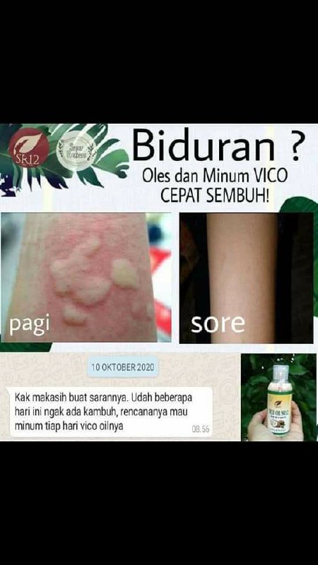 Punya masalah seperti ini?gak kunjung sembuh?malah telinga makin terasa pekak karna kbanyakan minum obat kimiaKata orang tua zaman dulu, hati2 jangan sampai naik ke lidah, karena lidah bisa kelu/kaku yang akhirnya bisa